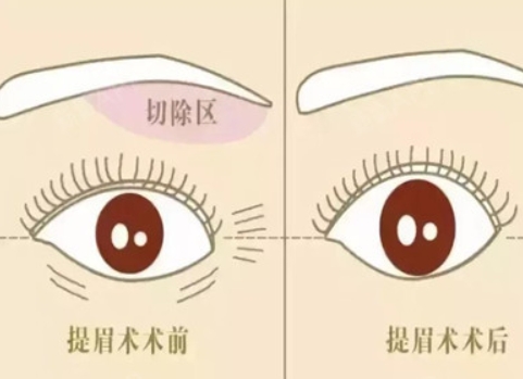 切眉6.jpg
