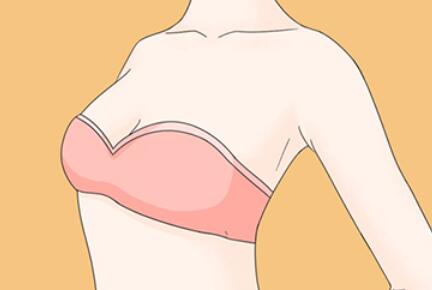 进口假体隆胸怎么样？护理简介危害有哪些公布，太香了