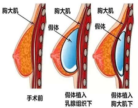QQ浏览器截图20210910101420.jpg