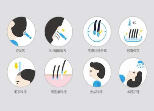 6000元植发效果图怎么样？真实案例赶紧收藏吧
