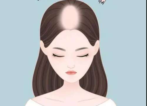 头发油腻又脱发怎么办？附上几个解决方式一览