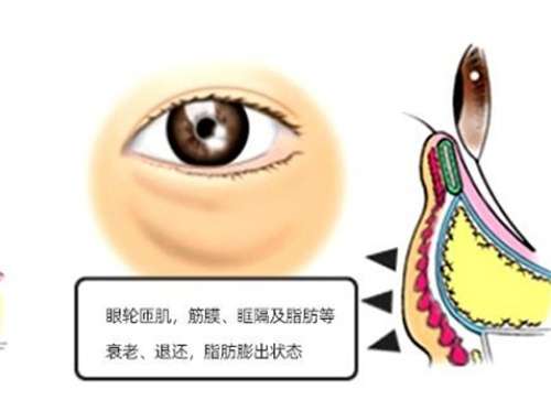 上海生命树医疗美容去眼袋价格？2025年价格表更新