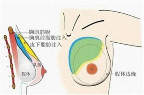 上海时光整形外科医院是正规医院吗？主打项目介绍，一键了解