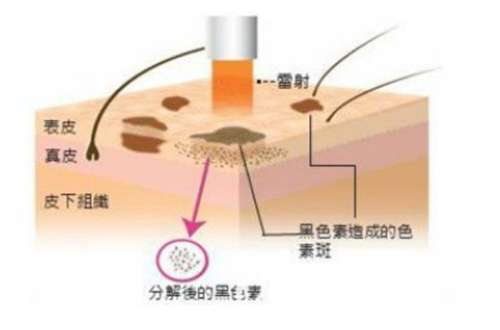 上海赛美瑞整形医院王亚军医生怎么样？主打项目介绍，速速围观