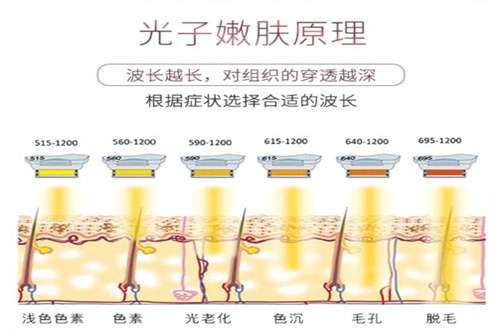 opt光子嫩肤多久做一次？相关注意事项已经整理了