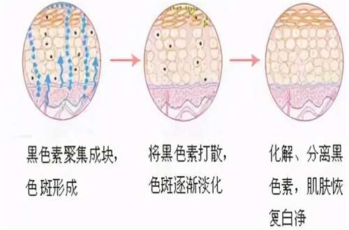 上海葆研医疗美容诊所怎么样？祛斑真是案例已经公布
