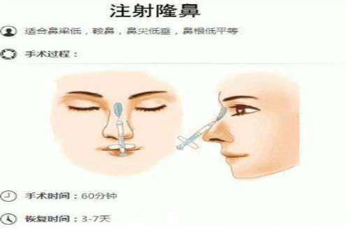 注射隆鼻原理.jpg