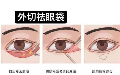 上海纽菲思医疗美容门诊部去眼袋怎么样?一键了解医院详情