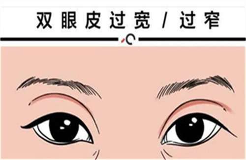 眼睛16.jpg