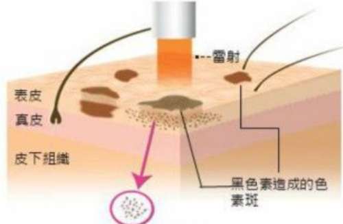 唐山市工人医院祛斑怎么样?医院详情介绍