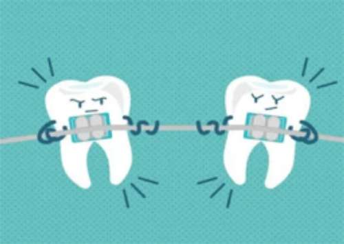 牙齿正畸医保可以报销吗？正畸清洁步骤？一文探索