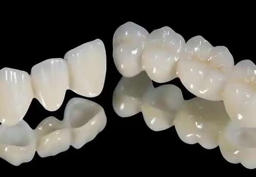 纯钛烤瓷牙和纯钛聚合瓷的区别有哪些？术后注意事项