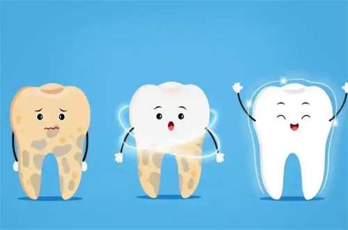 四环素牙齿可以变白吗？分析使用方法