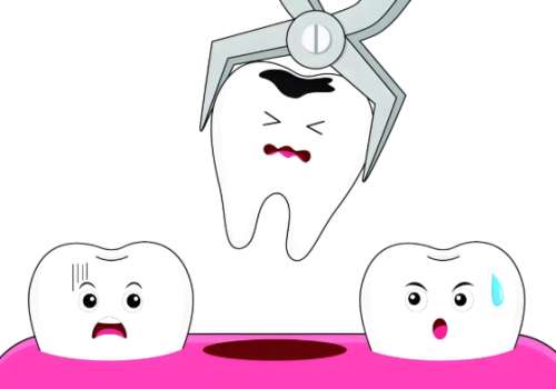 桂林哪个牙科拔智牙好又便宜？好又便宜的牙科找到了，赶紧收藏吧