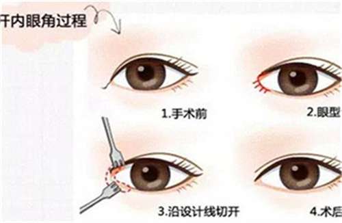 上海嘉人整形医院怎么样？特色项目介绍