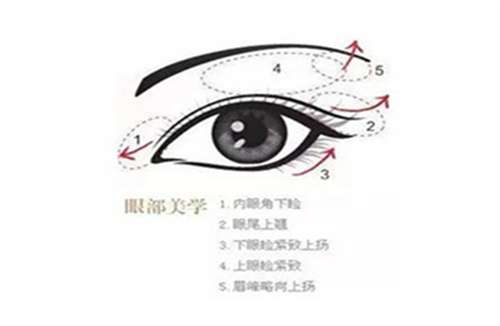 董香君双眼皮怎么样？医生口碑点评