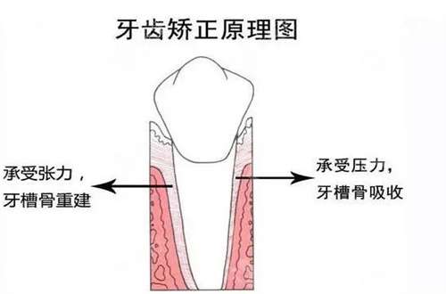 安丘口腔医院戴牙套价格贵吗？科普篇全新发表