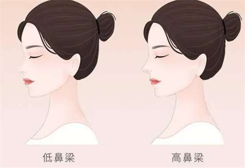 男生隆鼻要多少钱？大家关心的科普知识回答了