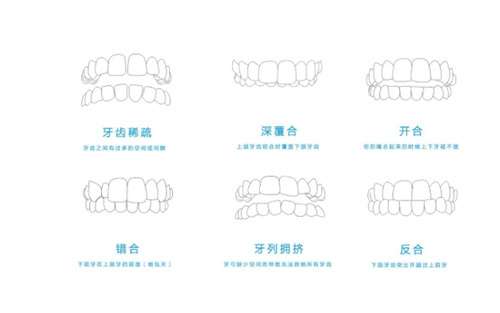 整牙齿矫正多少钱隐形矫正？隐形矫正时间是1年半吗？