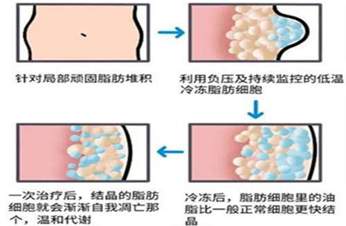上海时光整形外科医院抽脂怎么样？医院信息介绍