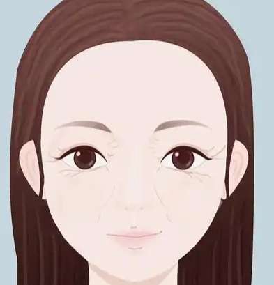 鱼尾纹除皱方法是什么?鱼尾纹除皱后如何保持状态