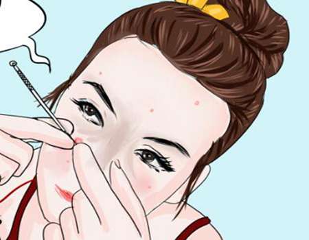 去痘印激光需要几次？激光祛痘印之后如何护理呢?