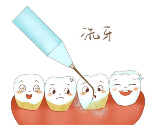 洁牙洗牙的区别有哪些？洗牙有危害吗？