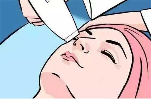 做热玛吉除皱效果怎么样？术后会反弹吗？