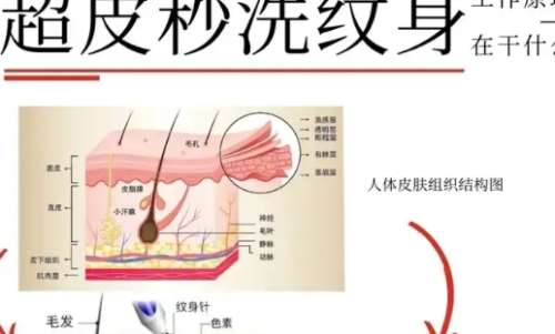 超皮秒洗纹身多久洗一次？超皮秒洗纹身有哪些副作用？