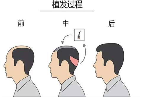 喀什新禾植发医疗美容怎么样?带你了解基本简介信息