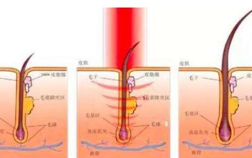 厦门第一医院思明分院祛斑怎么样？医院特色项目介绍
