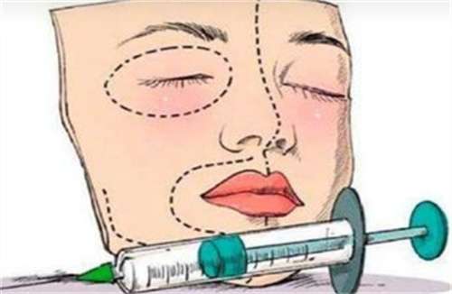 法欧曼玻尿酸多少钱一支？法欧曼玻尿酸是大分还是小分？