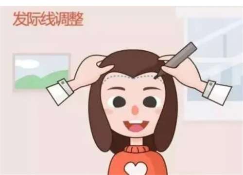 毛发移植效果怎么样？术后注意事项公布
