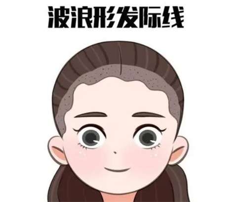 头发种植术植发一般价格是多少？植发要住院吗？