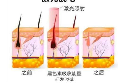中国医科大学附属第一医院激光脱毛？医院基本信息在线了解