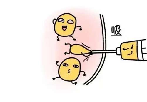 拜拜肉吸脂多久没有拉扯感？局麻疼吗？