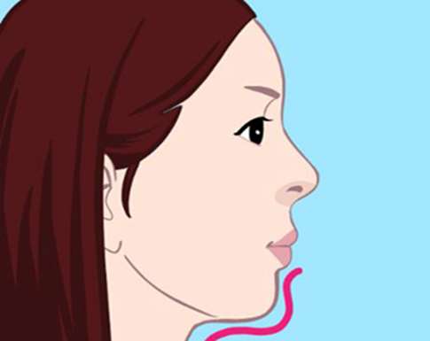 光纤溶脂去双下巴是永久的吗？速来看看人气项目详情