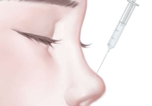 双美胶原蛋白隆鼻是合法的吗？双美胶原蛋白隆鼻适应症有哪些？