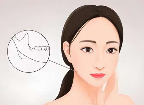 颌成型手术可以维持多久？这几点术前一定要多看看！