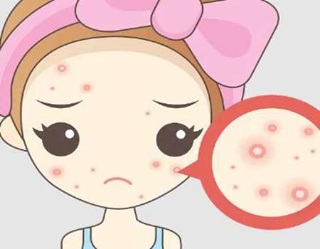 缩小毛孔的医美项目怎么样？这三种根据自己的情况选择哦