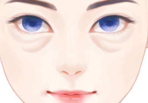 眼袋修复.jpg