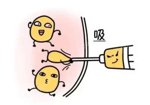 吸脂4.jpg