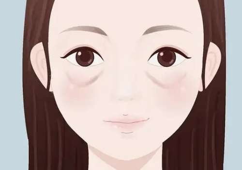 眼袋3.jpg