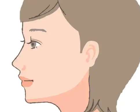 下颌缘颈阔肌提升怎么样?常见解决方法一览查看