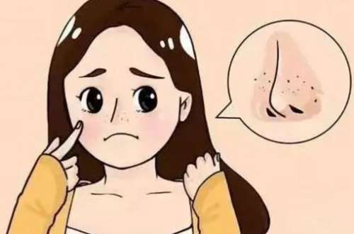酒糟鼻整形术价格是多少？酒糟鼻要怎样诊疗？