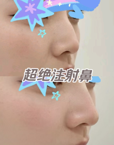 濡白天使和宝尼达哪个适合打鼻子? “梦中情针”究竟花落谁家?