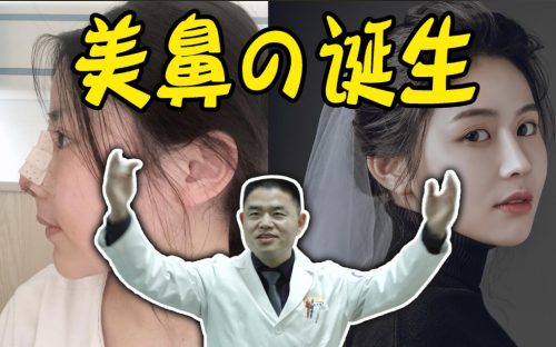 李保锴鼻子做得怎么样？雕琢自然之美