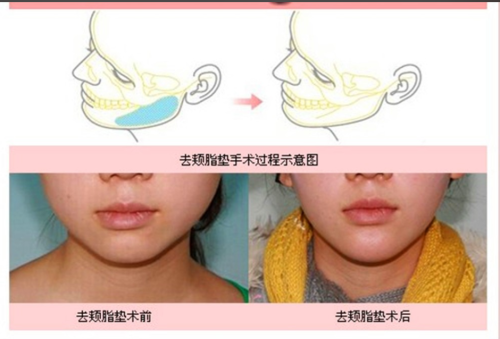 wechat_2025-07-07_172229_621.png