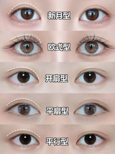 双眼皮有几种款式？这么多隐藏款你知道吗