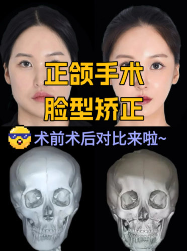 广大医院做正颌手术做的怎么样？有兴趣的朋友赶紧来看看